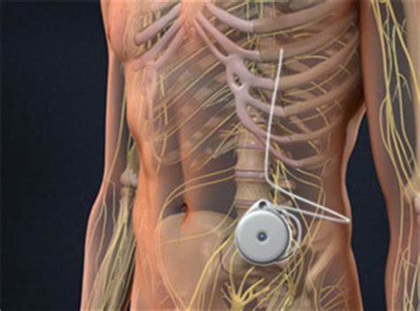 Spinal medication pumps