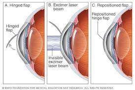 eye3