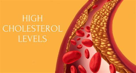 high cholesterol