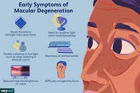macular degeration 4