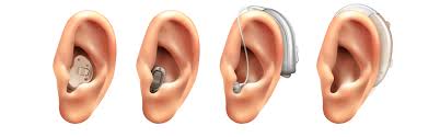hearing aids