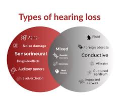 hearing loss 3