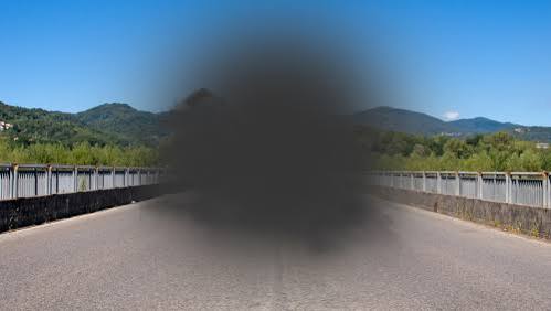 macular degeneration macular degeneration